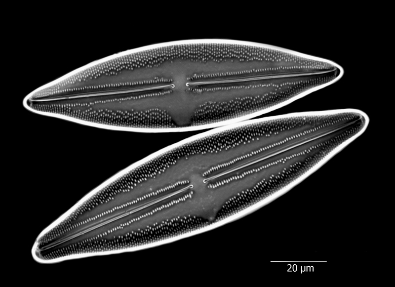 Anomoeoneis sphaerophora f. sculpta #66981