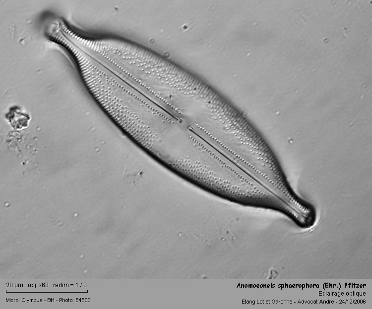 Anomoeoneis sphaerophora (Ehr.) Pfitzer #5343