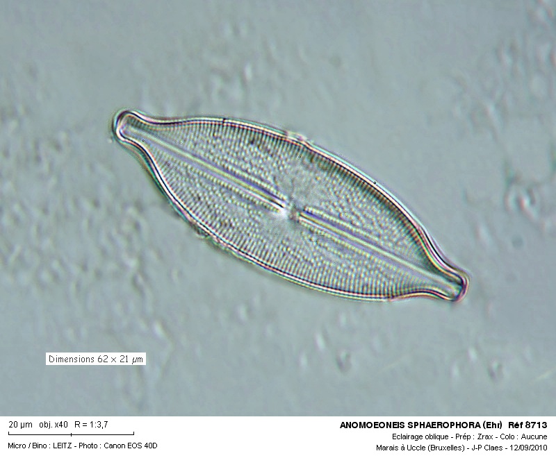 ANOMOEONEIS SPHAEROPHORA #18031