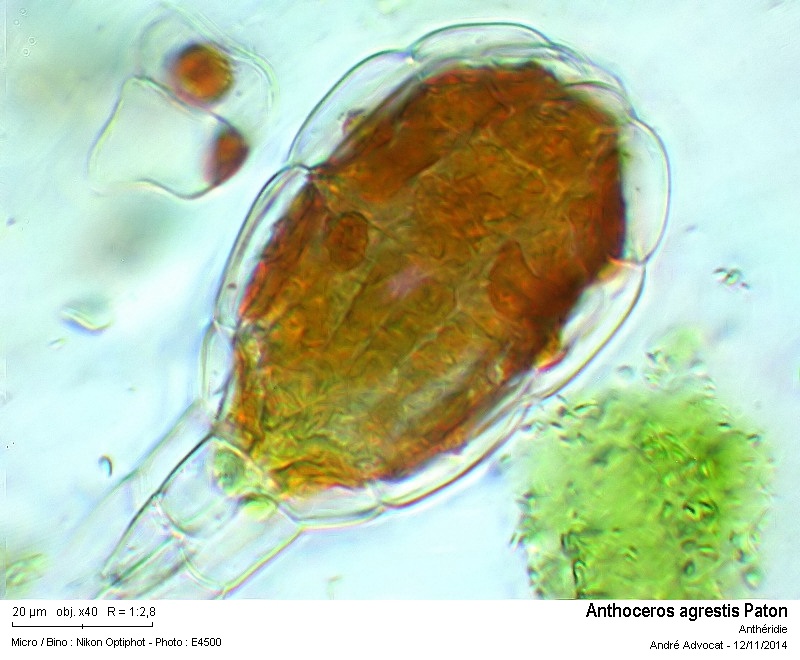 Anthoceros agrestis Paton #39692