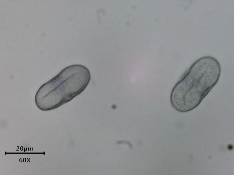 Anthriscus sylvestris (L.) Hoffm - Cerfeuil des bois - pollen #86276