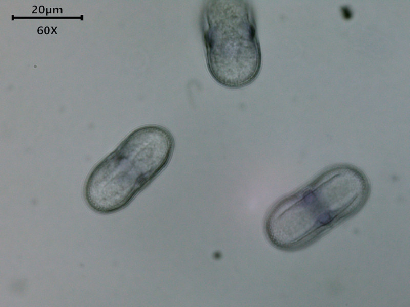 Anthriscus sylvestris (L.) Hoffm - Cerfeuil des bois - pollen #86277