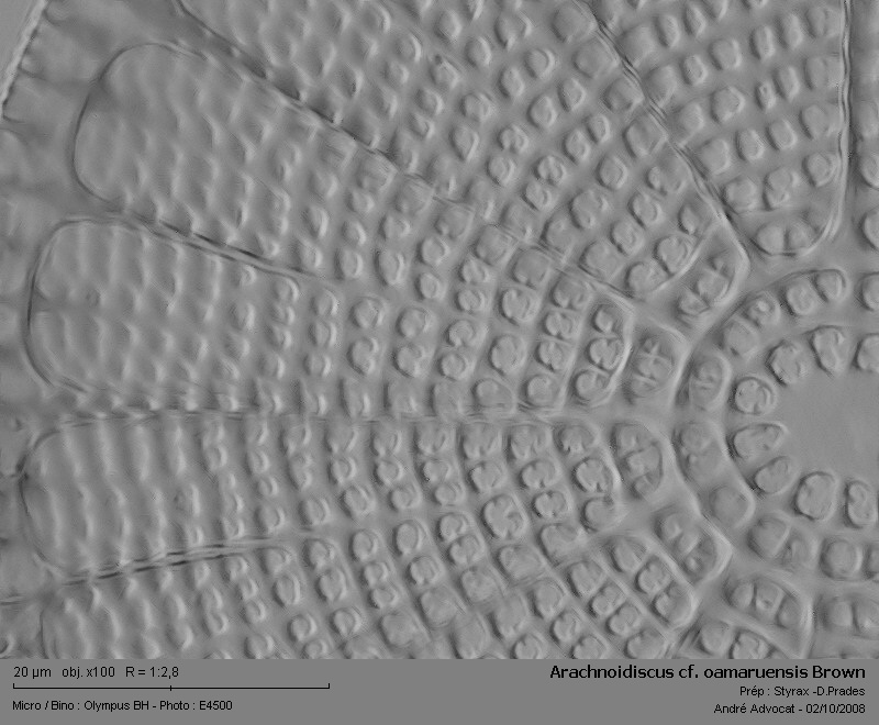 Arachnoidiscus cf. oamaruensis Brown #5970