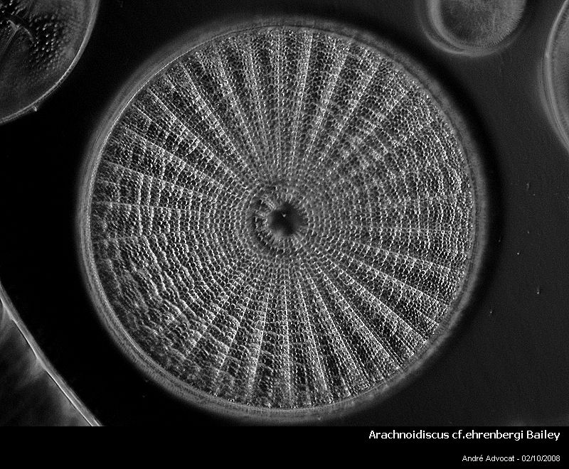 Arachnoidiscus ehrenbergi Bailey=Arachnoidiscus ornatus Ehr #5835
