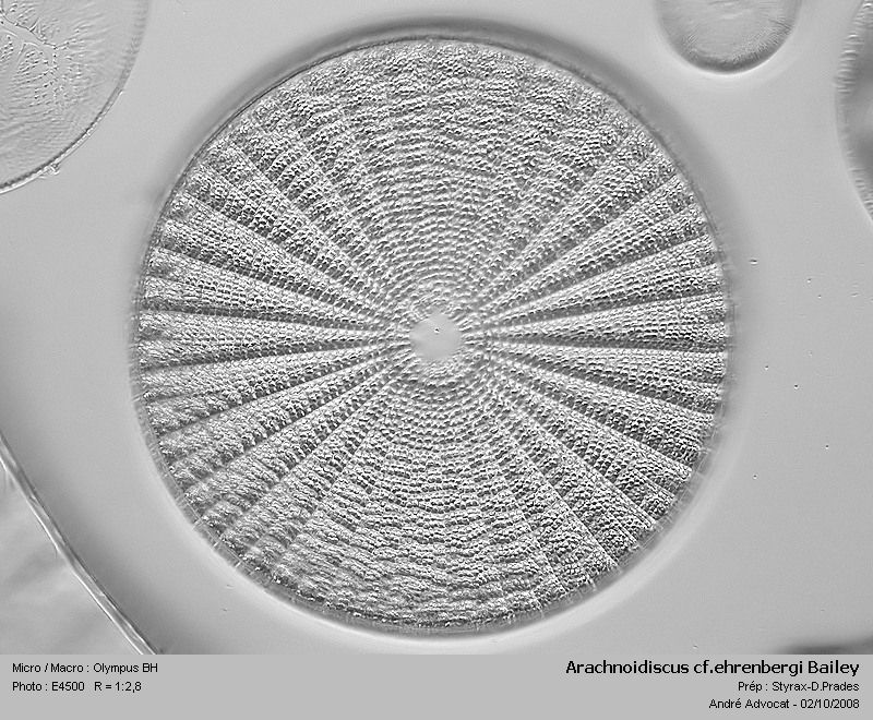 Arachnoidiscus ehrenbergi Bailey=Arachnoidiscus ornatus Ehr #5836