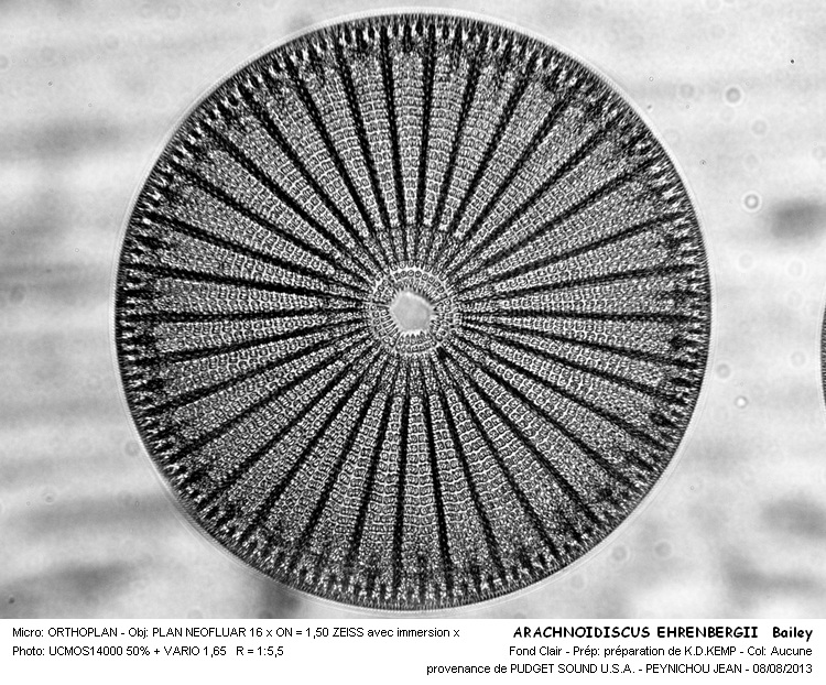 ARACHNOIDISCUS EHRENBERGII Bailey #33159