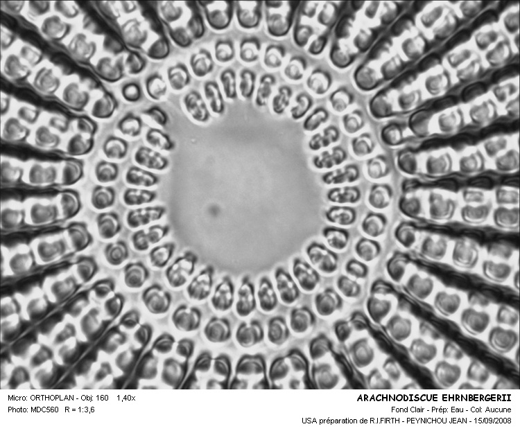 ARACHNOIDISCUS EHRENBERGII #32315