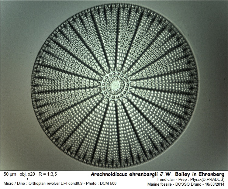 Arachnoidiscus ehrenbergii J.W. Bailey in Ehrenberg #36817