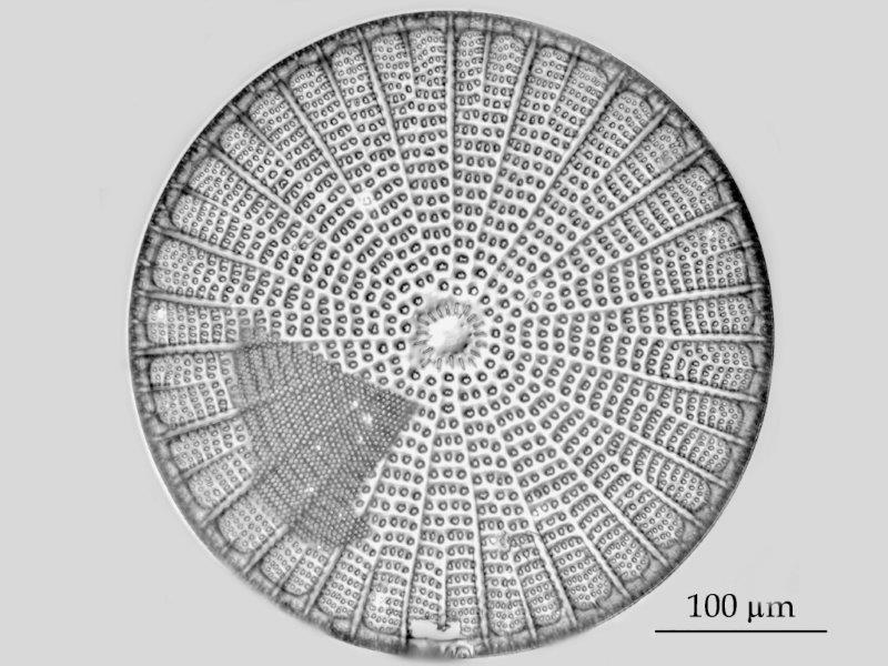 Arachnoidiscus ehrenbergii #56723