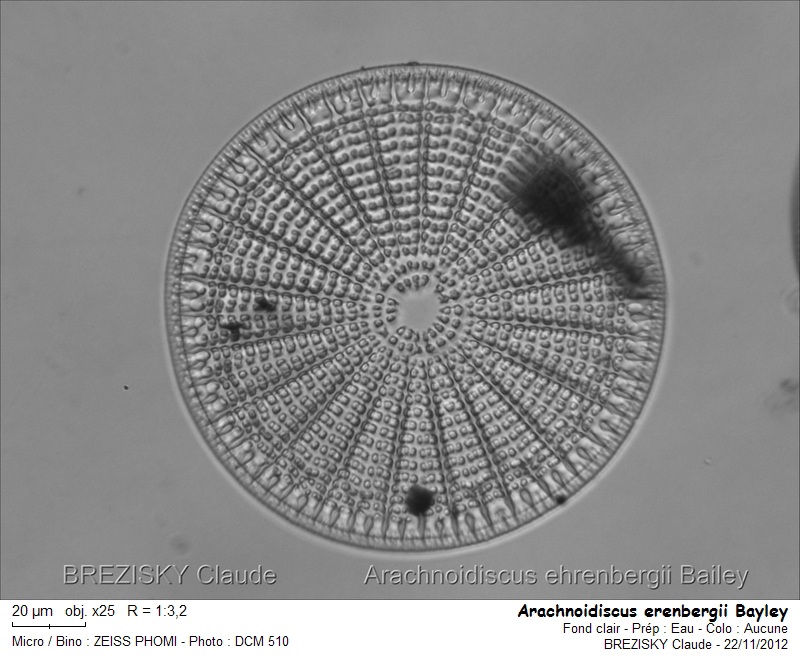 Arachnoidiscus ehrenbergii Bailey #28970