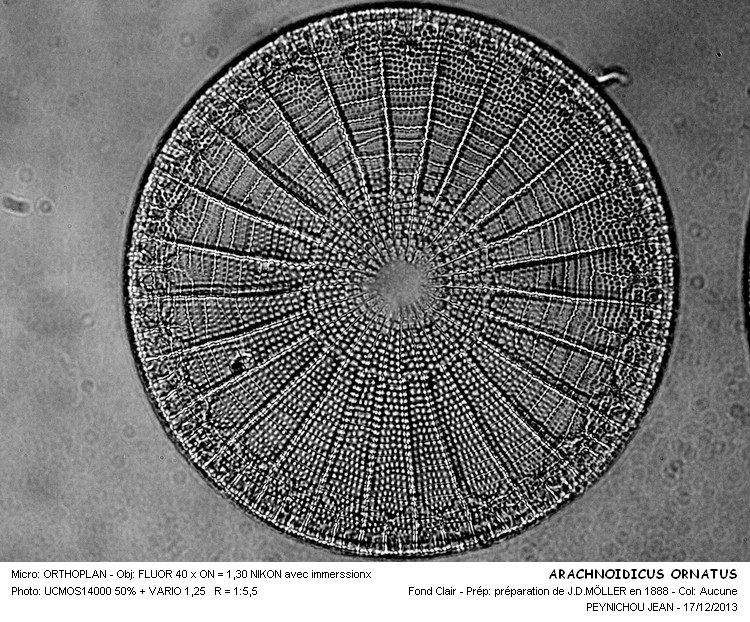 ARACHNOIDISCUS ORNATUS #35261