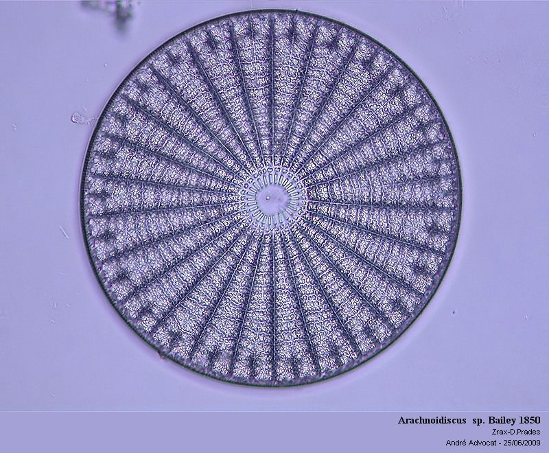 Arachnoidiscus sp. Bailey 1850 #11332