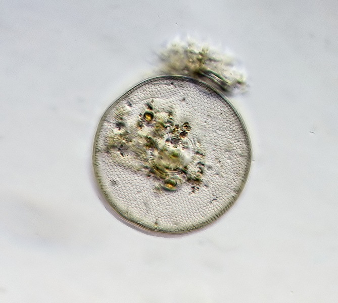 Arcella #39502