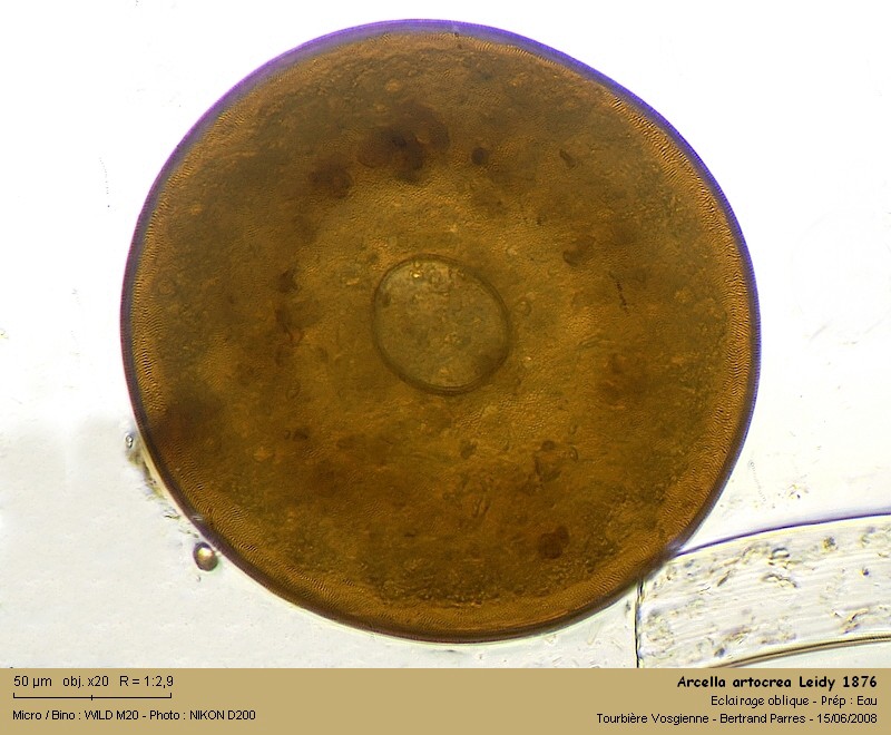 Arcella artocrea Leidy, 1876 #4984