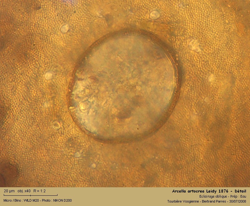 Arcella artocrea Leidy, 1876 #4986