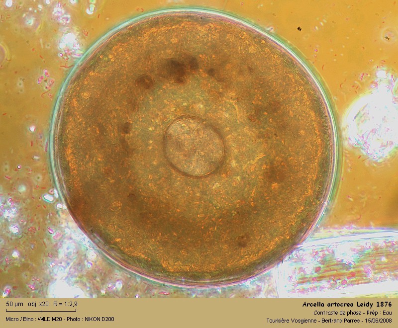 Arcella artocrea Leidy, 1876 #4985