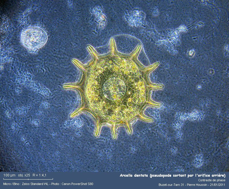 Arcella dentata (amibe à thèque) #20219