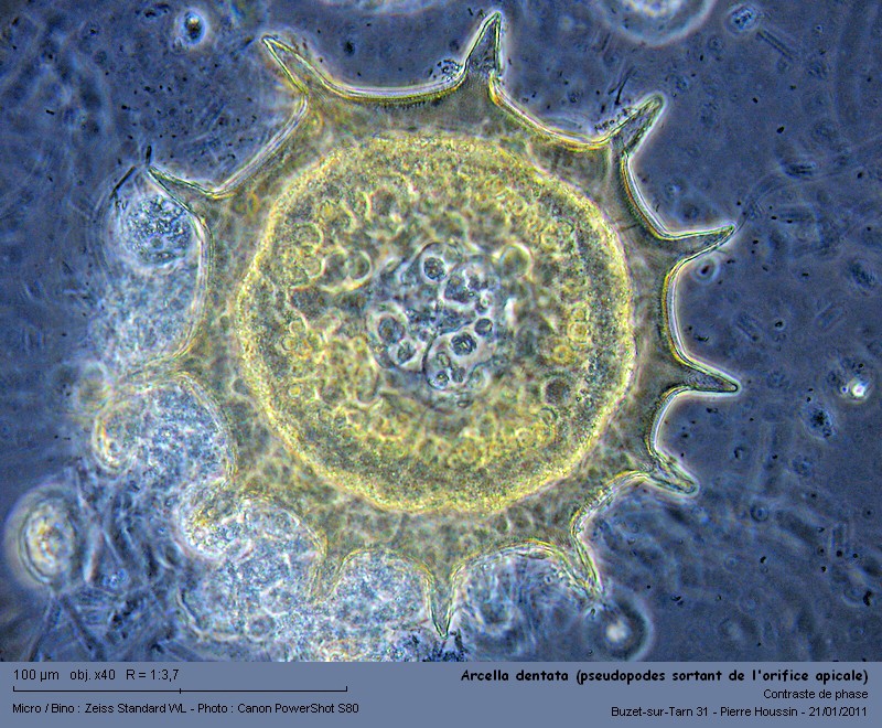 Arcella dentata (amibe à thèque) #20216