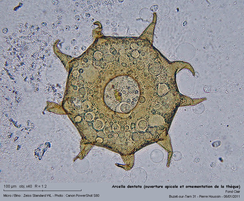 Arcella dentata (amibe à thèque) #20217
