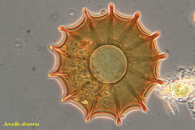 Arcella denticulata 3 Versions #34392