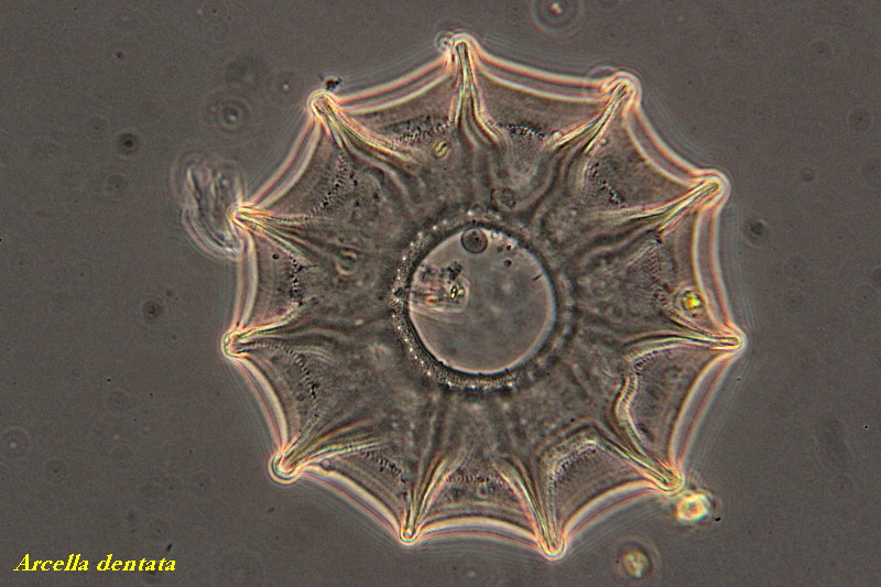 Arcella denticulata 3 Versions #34391