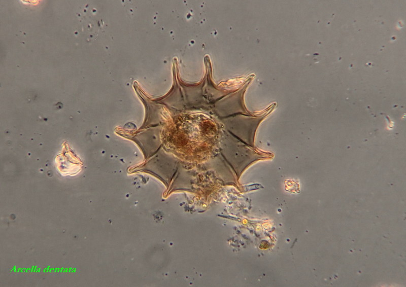 Arcella denticulata 3 Versions #34393