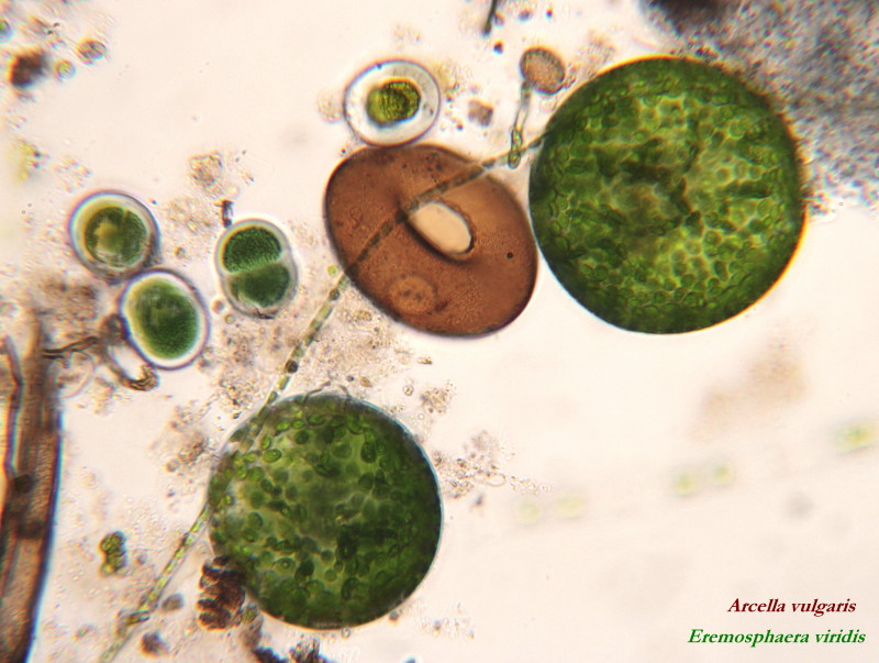 Arcella vulgaris #34061