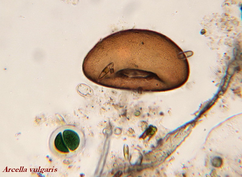 Arcella vulgaris #34060