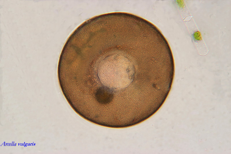 Arcella vulgaris #34059