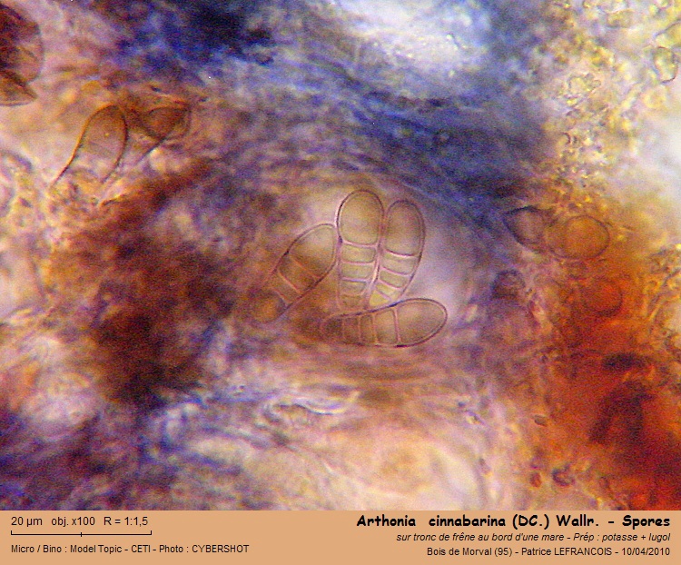 Arthonia  cinnabarina (DC.) Wallr. #15720