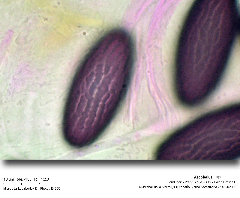 Ascobolus sp. #3535