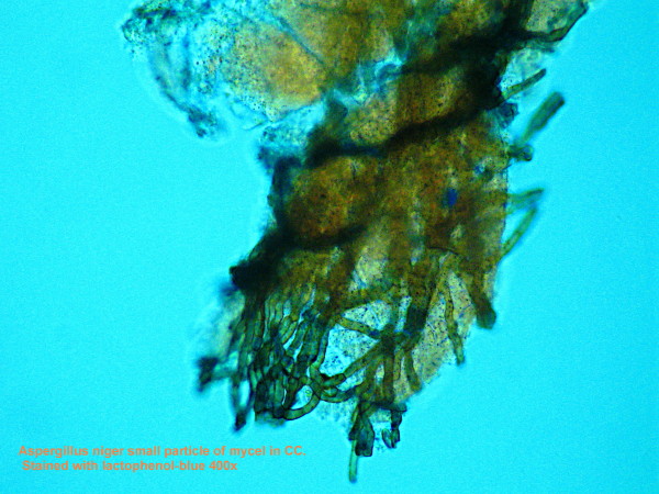 Aspergillus niger un ascomycète qui détruit du plastique #5192