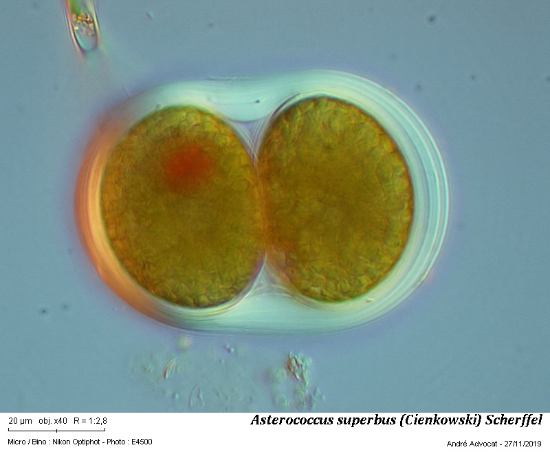 Asterococcus superbus (Cienkowski) Scherffel #61012
