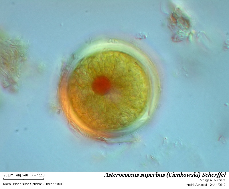 Asterococcus superbus (Cienkowski) Scherffel #61014