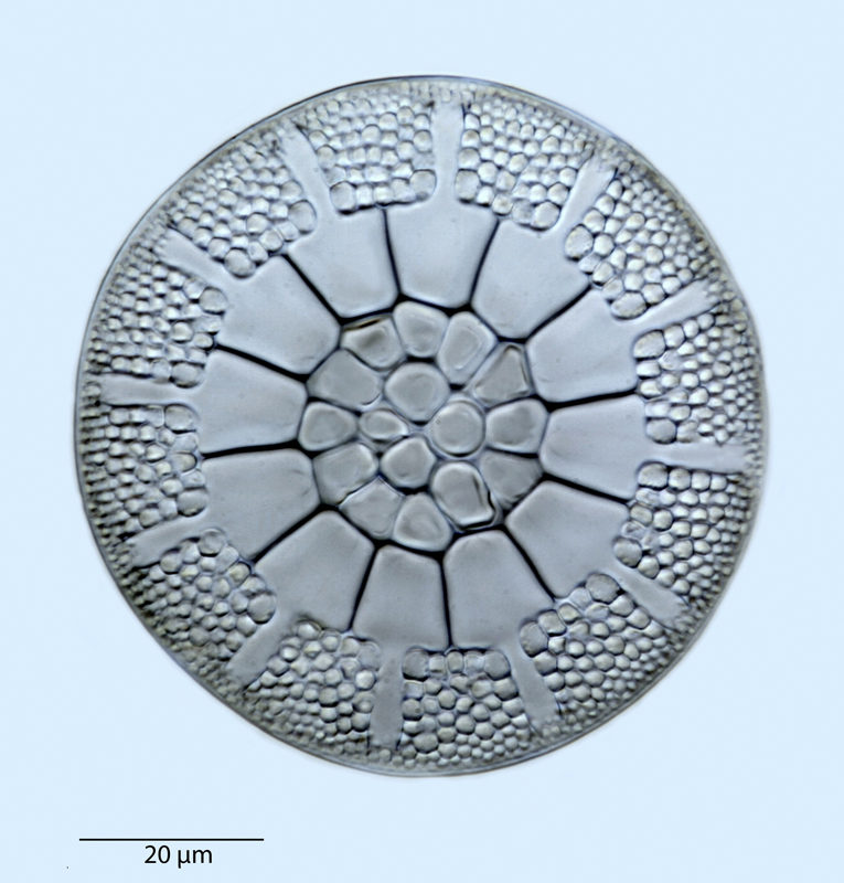 Asterolampra decora #40833
