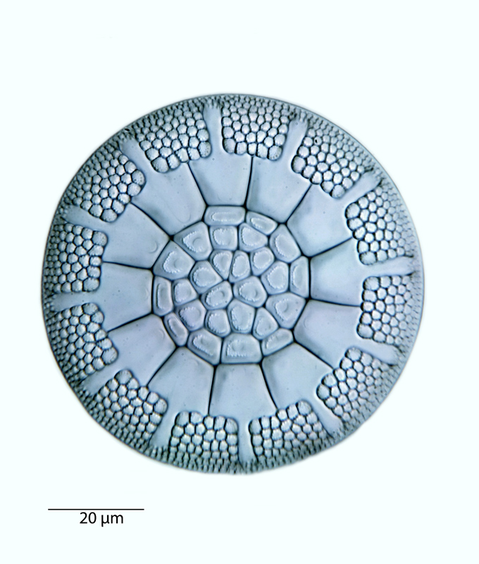 Asterolampra insignis #40755
