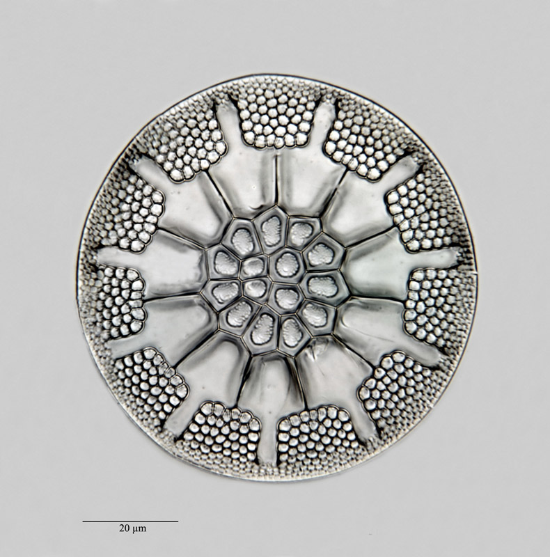 Asterolampra insignis Schmidt #23439