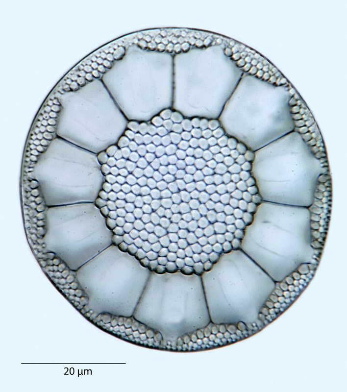 Asterolampra marginator Greville #40001