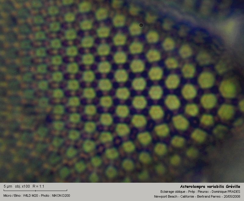 Asterolampra variabilis Greville 1860 #3975