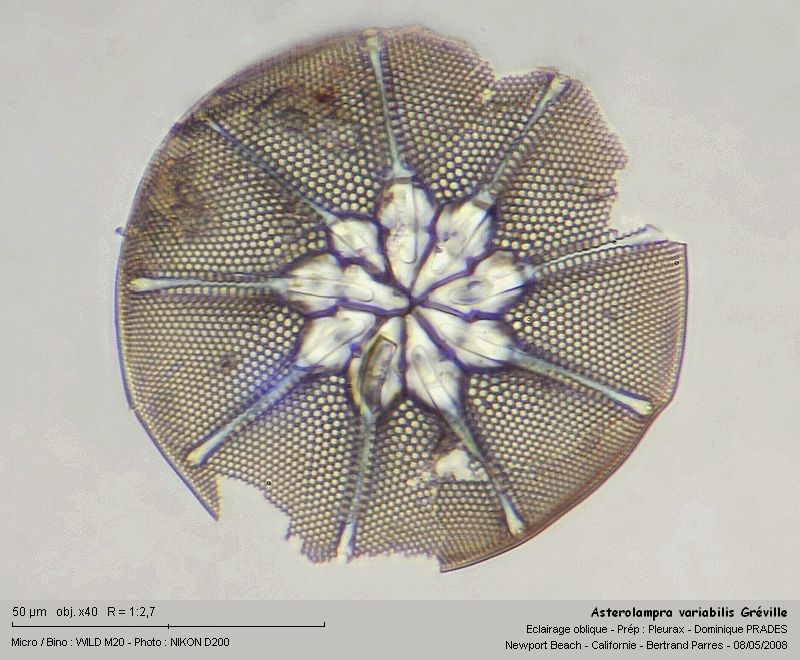 Asterolampra variabilis Greville 1860 #3973