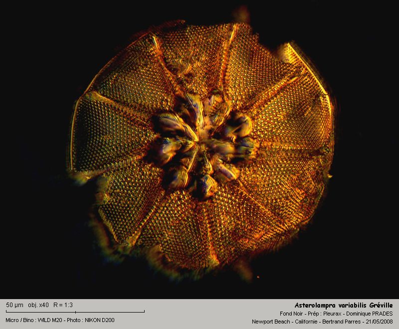 Asterolampra variabilis Greville 1860 #3977