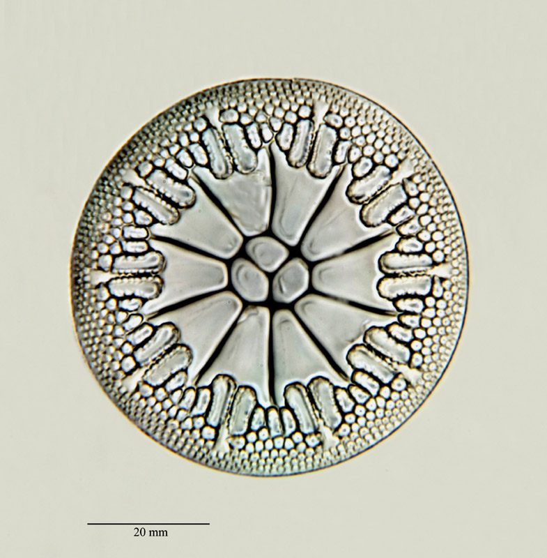 Asterolampra vulgaris Greville #23440
