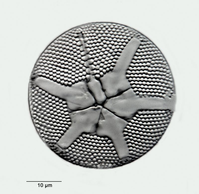 Asteromphalus brookei Bailey #31035