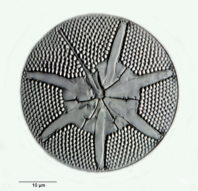 Asteromphalus brookei Bailey #31036