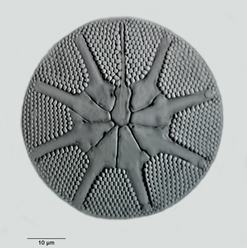 Asteromphalus brookei Bailey #31037