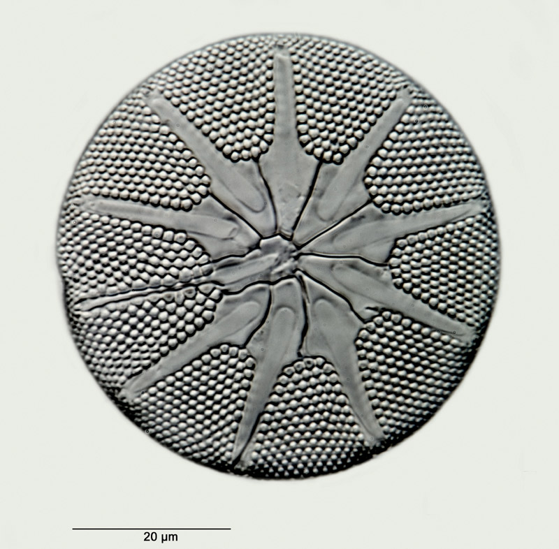 Asteromphalus brookei Bailey #31039