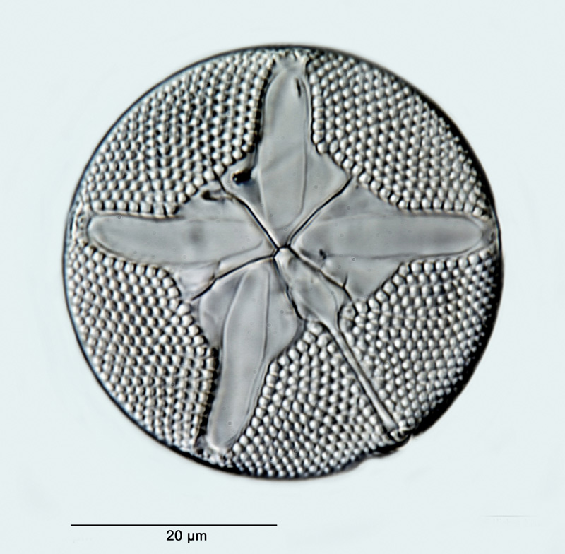 Asteromphalus brookei Bailey #31034