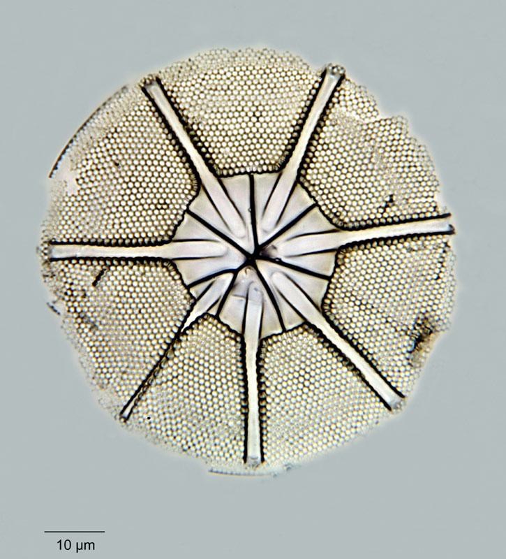 Asteromphalus humboldtii Ehrenberg #18784