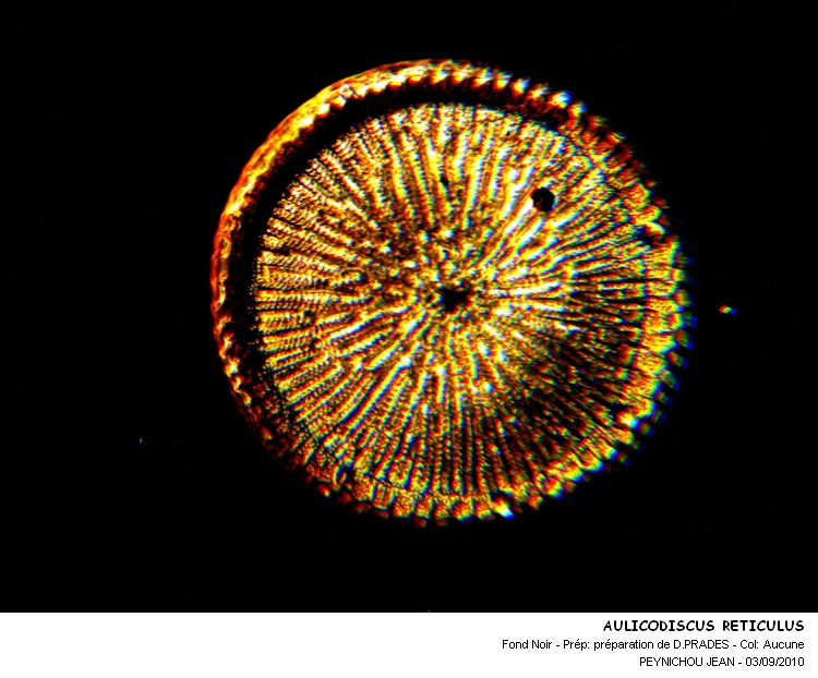 AULACODISCUS  RETICULATUS #32364