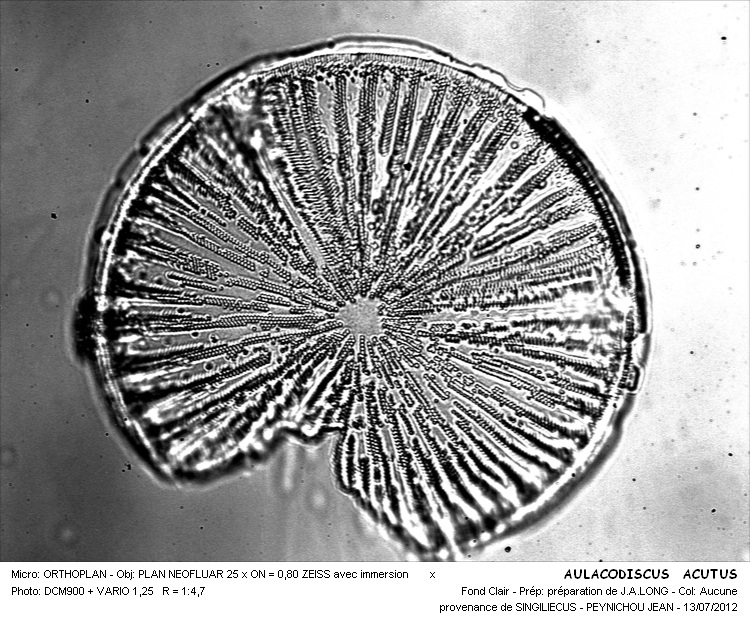 AULACODISCUS ACUTUS #32336